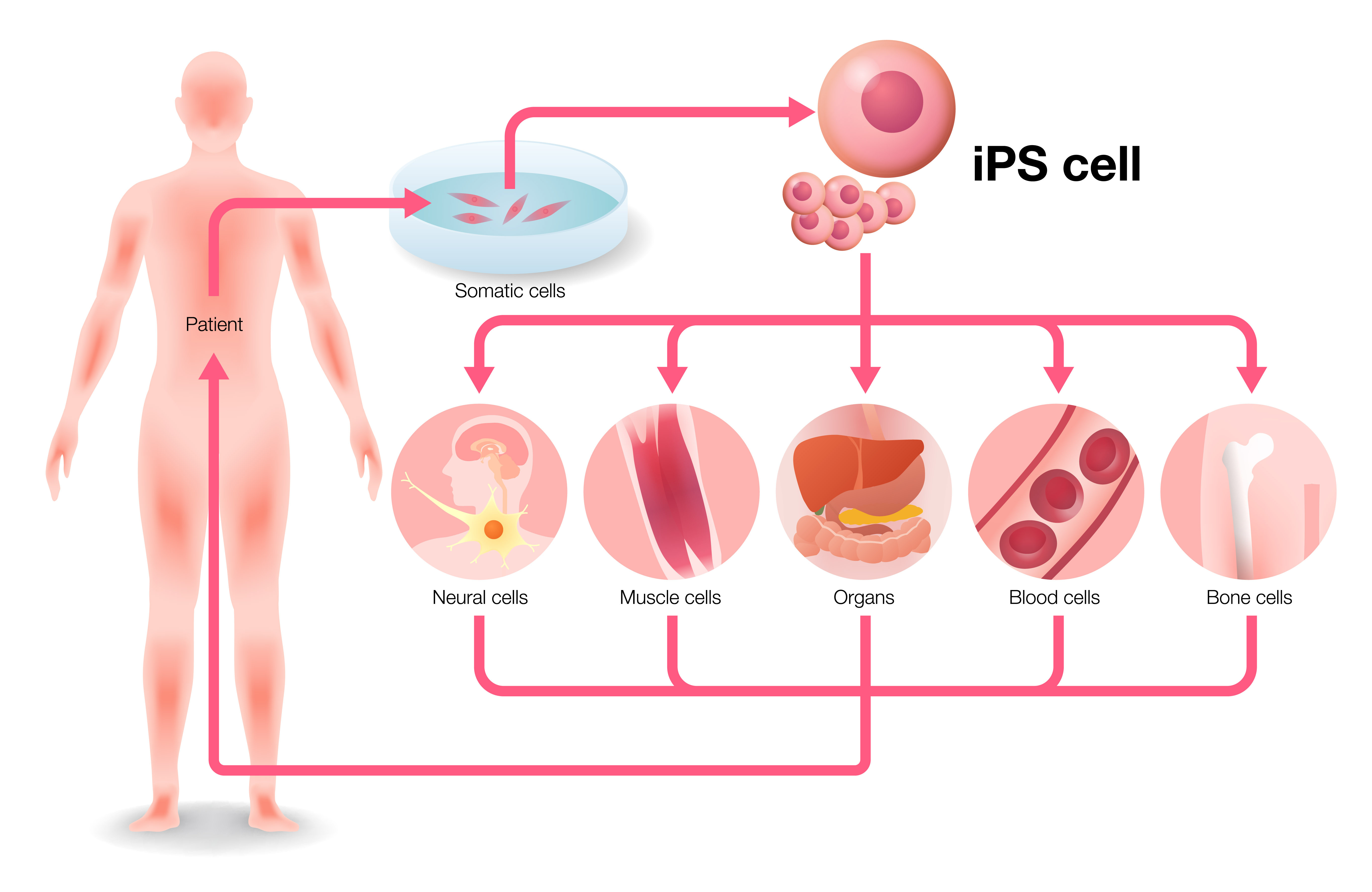 iPS細胞と再生医療